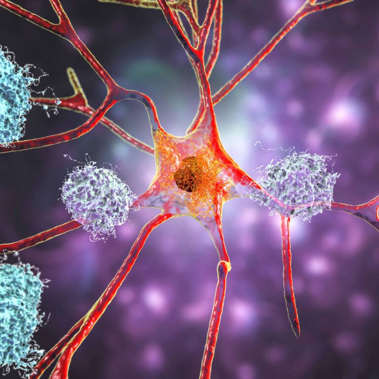 Pioneering Alzheimer’s Research at Rutgers: Dr. William Hu’s Breakthroughs in Early Detection and Prevention